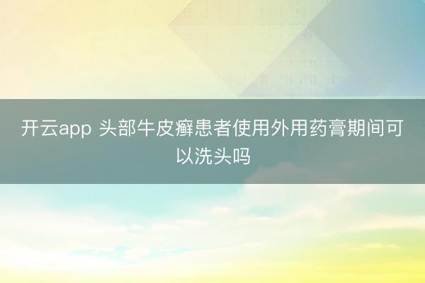 开云app 头部牛皮癣患者使用外用药膏期间可以洗头吗